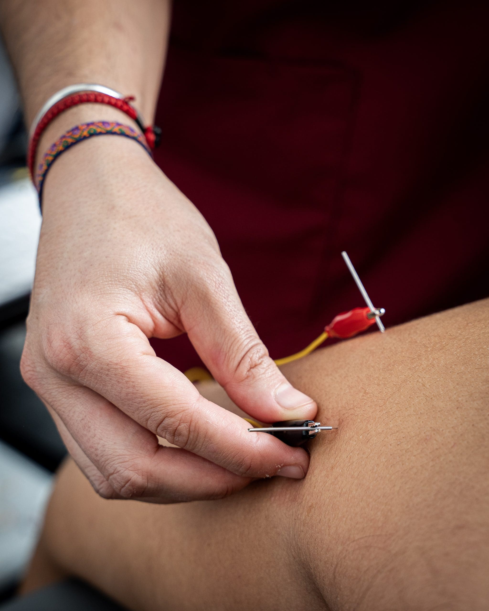 TƩcnicas invasivas de fisioterapia en Zutittu OƱati